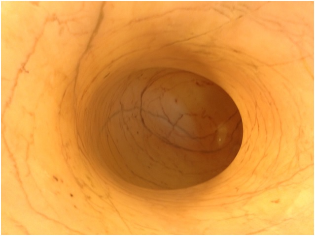 Sophia -2003 –Mermer
